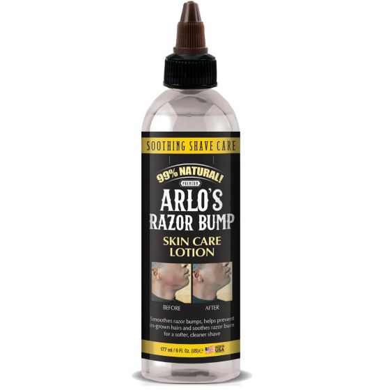 Arlo's Razor Bump Skin Care Lotion 177m